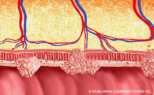 The Gastrointestinal Tract